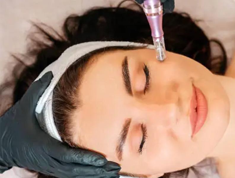 میکرونیدلینگ